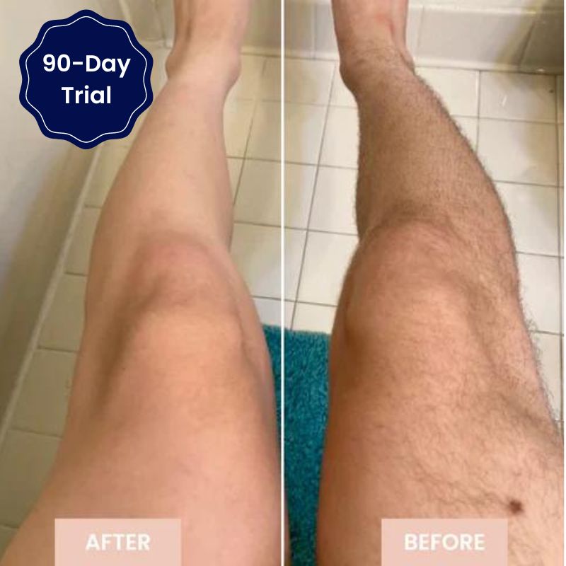Smooth Skin No Bumps, Burns, Or Irritation - SmoothBeam
