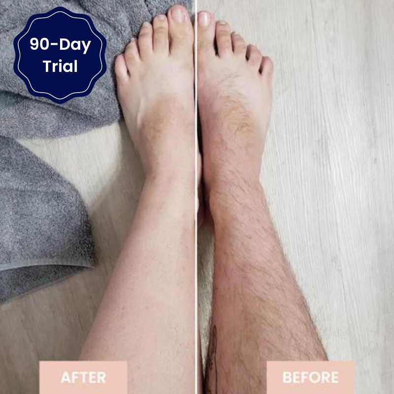 Smooth Skin No Bumps, Burns, Or Irritation - SmoothBeam