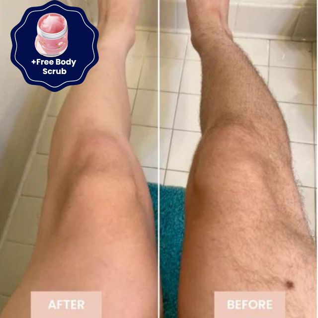 No Bumps, No Burns, No Ingrowns with SmoothBeam